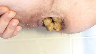 Shitting hard rocks