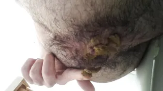 Shitting and fingering the ass