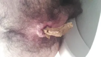 Hairy shit hole