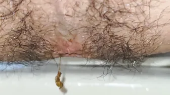 Taiwanese Guy With Hairy Ass Pushing His Shit Out (Close-Up)