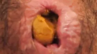 Anus When Defecating (Compilation)