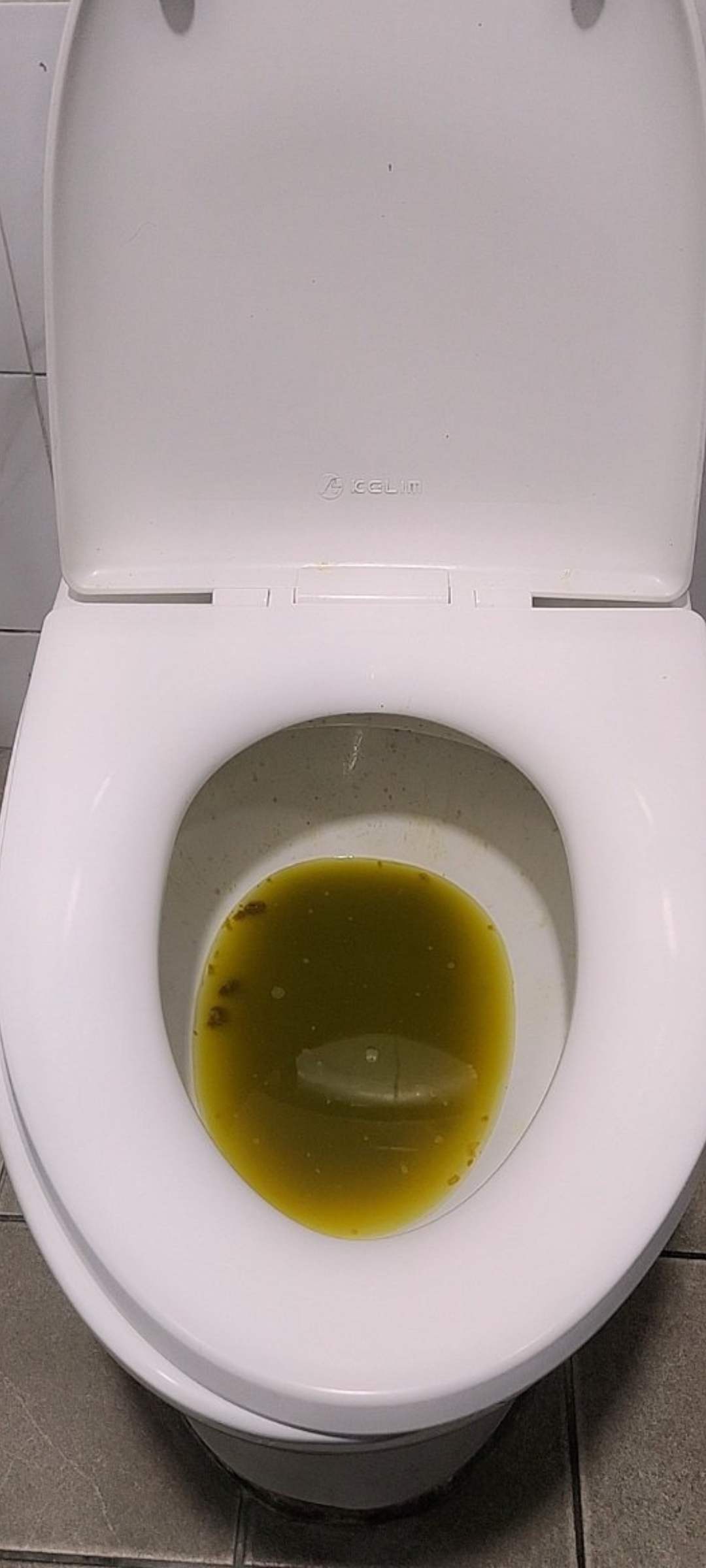 diarrhea 2
