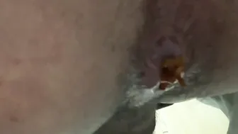 Peeping Asian Guys Holes Close Up 2