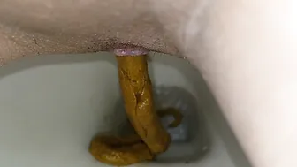 My pooping4